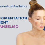 Hyperpigmentation Treatment in San Anselmo