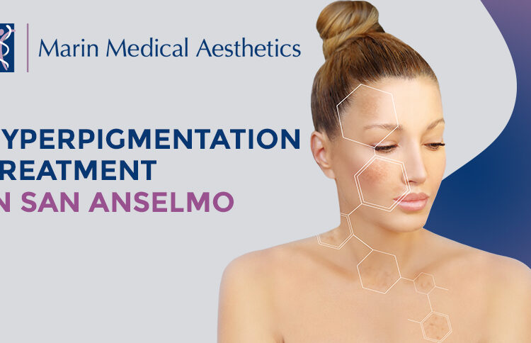 Hyperpigmentation Treatment in San Anselmo