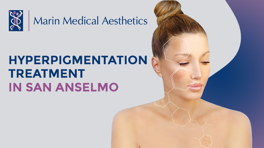 Hyperpigmentation Treatment in San Anselmo