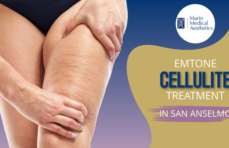 Marin Medical Aesthetics, Emtone Cellulite Treatment in San Anselmo,