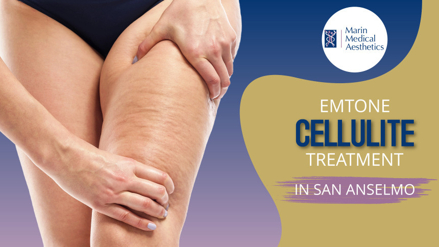 Marin Medical Aesthetics, Emtone Cellulite Treatment in San Anselmo,