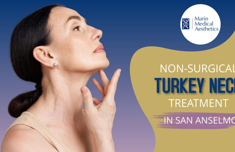 Nonsurgical Turkey Neck Treatment in San Anselmo