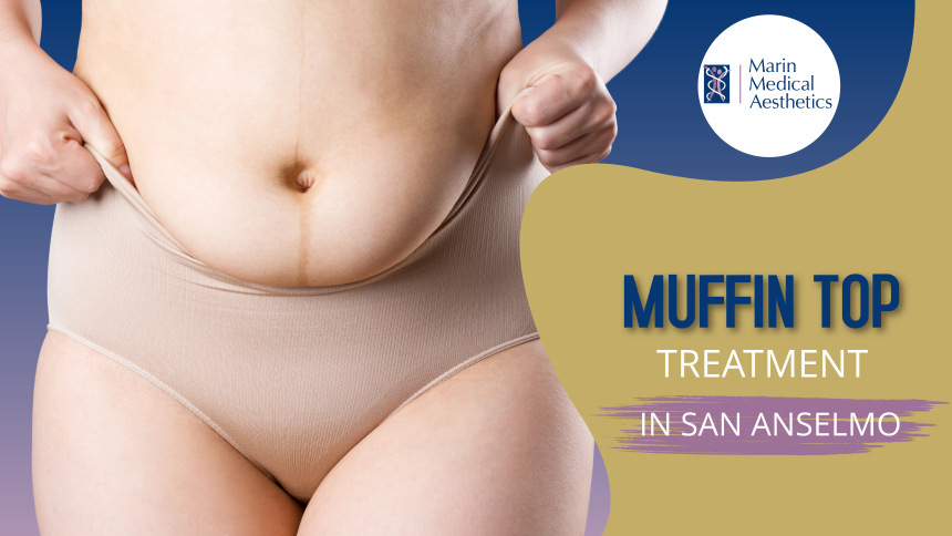 Muffin Top Treatment in San Anselmo