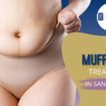 Muffin Top Treatment in San Anselmo