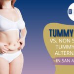 Tummy Tucks vs. Non-Surgical Tummy Tuck Alternatives in San Anselmo